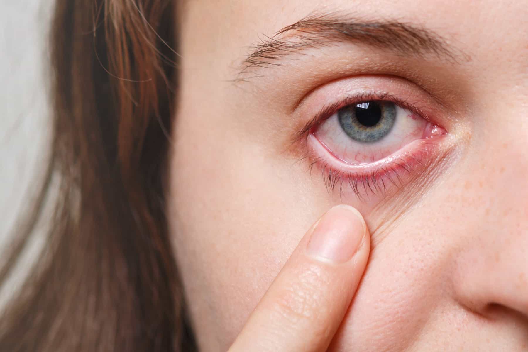 Vaak last van droge ogen?